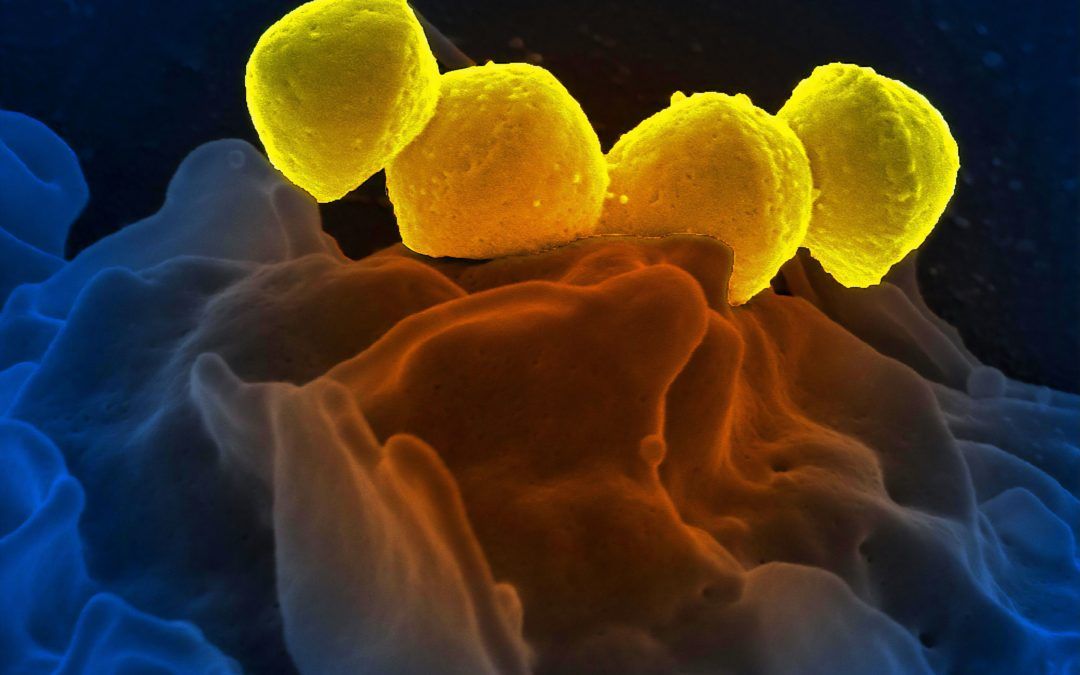 ¿Qué es la Microbiota Intestinal?